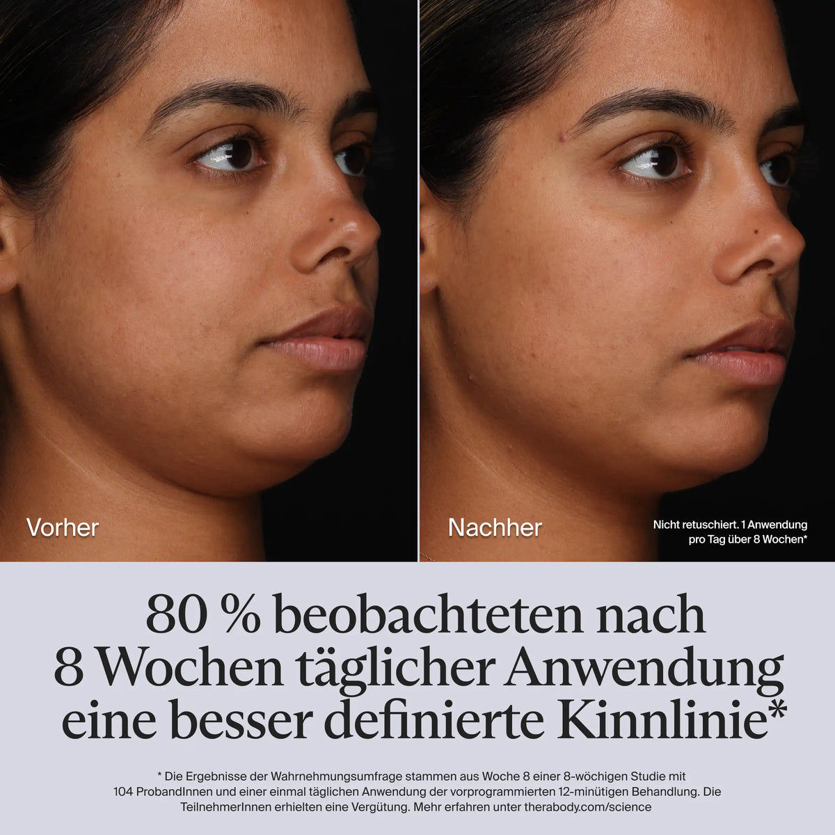Therabody SkinSpa PRO Vorher-Nachher-Vergleich: Seitenprofil einer Frau, links vorher, rechts nach 8 Wochen täglicher Anwendung, nicht retuschiert. Laut Wahrnehmungsumfrage beobachteten 80 % eine besser definierte Kinnlinie, Studie mit 104 Probandinnen und Probanden, 12-minütige Behandlung, Teilnehmende vergütet